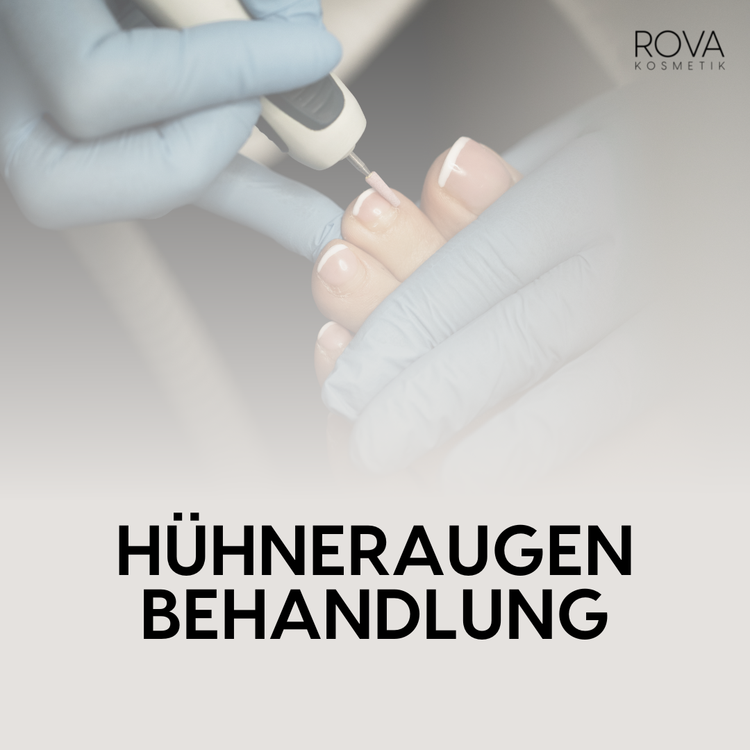 Hühneraugen Behandlung