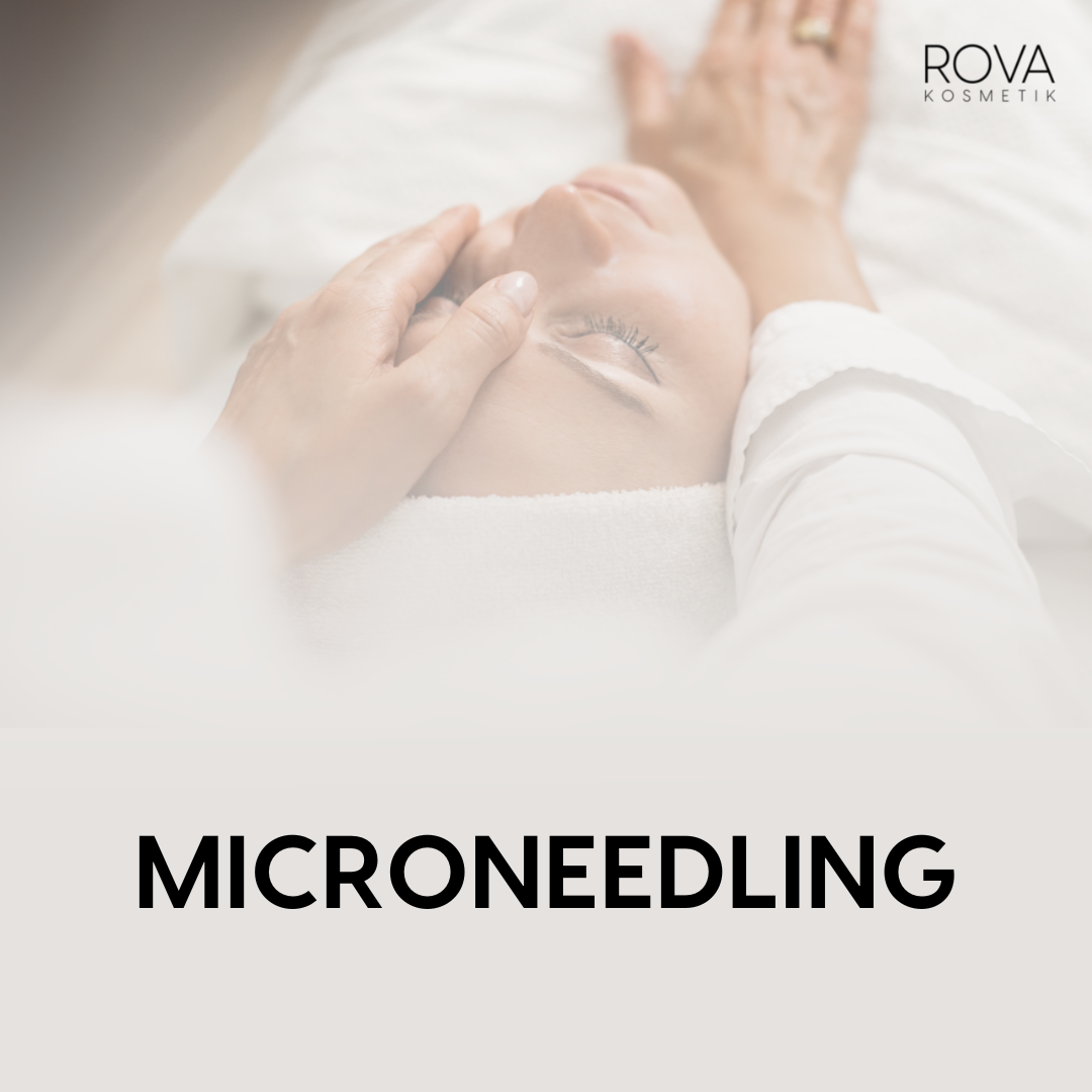 MICRONEEDLING